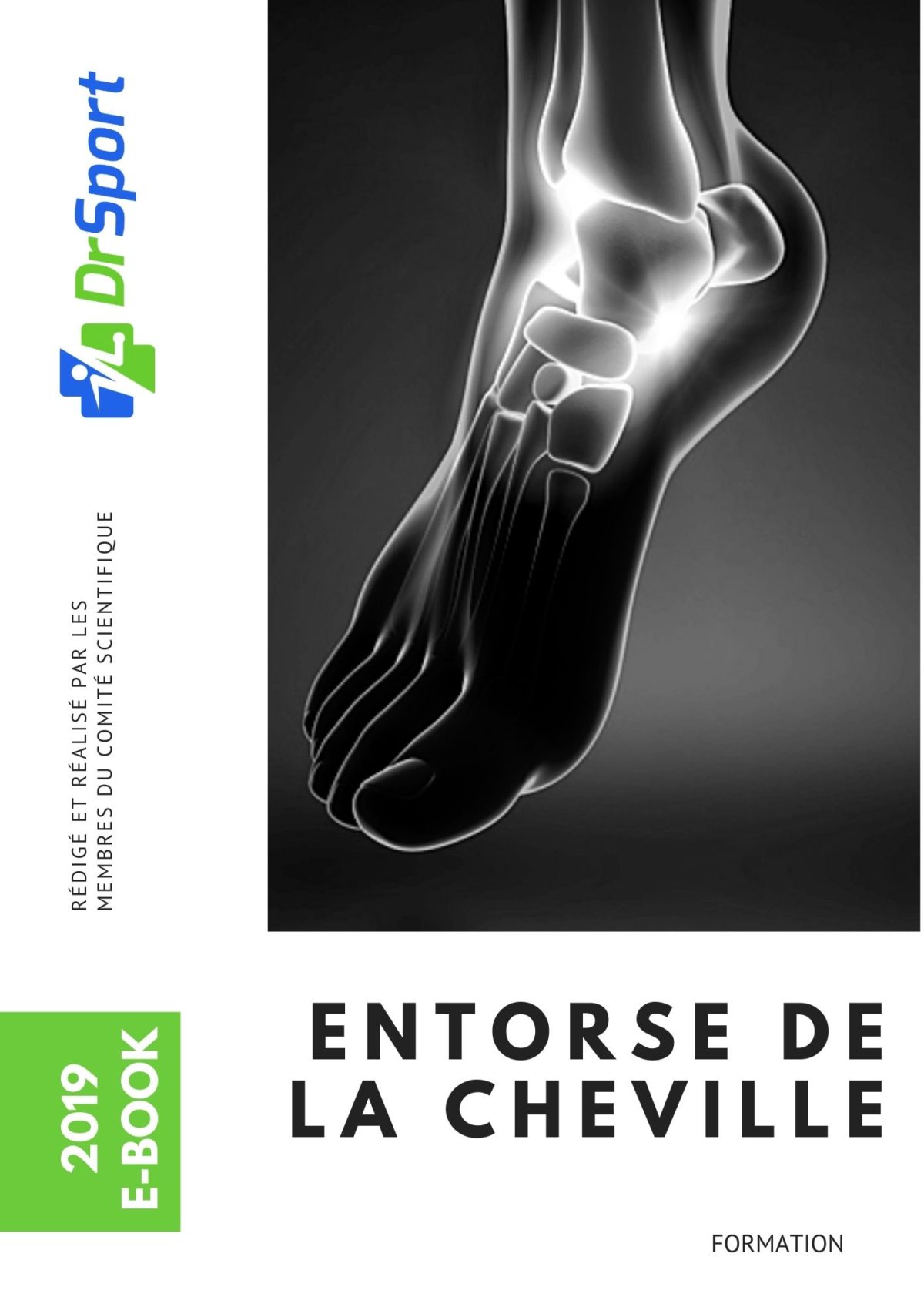 L’entorse de la cheville – Ebook DrSport