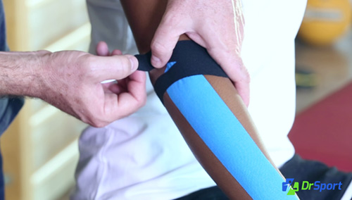 Comment réaliser un kinésio tape pour une tendinite du coude (Epicondylite ou Tennis Elbow) ?